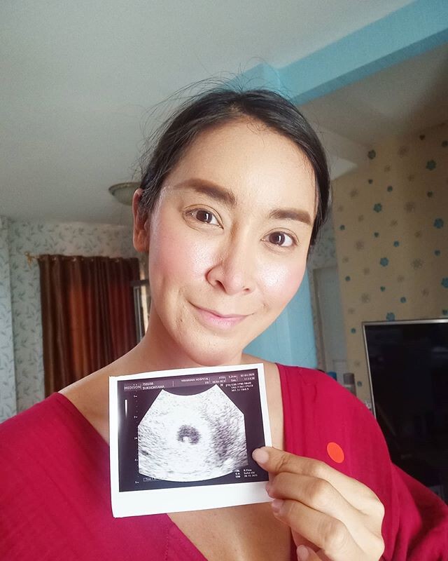 คนท้องให้โชค "ใหม่ สุคนธวา" แฟนๆตีความฝันแม่น 9 งวดติด ได้เฮถูกหวยอีกแล้ว