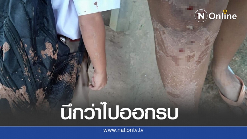 ชาวบ้านจะไม่ทน ส่งลูกหลานไปรร.แผลเต็มตัว ตกใจนี่หรือสภาพถนน วนรถกลับแทบไม่ทัน ชาวบ้านจะไม่ทน ส่งลูกหลานไปรร.แผลเต็มตัว ตกใจนี่หรือสภาพถนน วนรถกลับแทบไม่ทัน