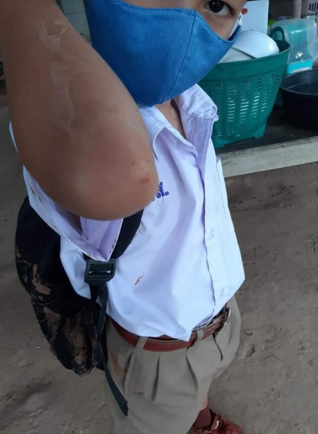 ชาวบ้านจะไม่ทน ส่งลูกหลานไปรร.แผลเต็มตัว ตกใจนี่หรือสภาพถนน วนรถกลับแทบไม่ทัน