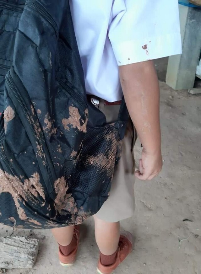 ชาวบ้านจะไม่ทน ส่งลูกหลานไปรร.แผลเต็มตัว ตกใจนี่หรือสภาพถนน วนรถกลับแทบไม่ทัน