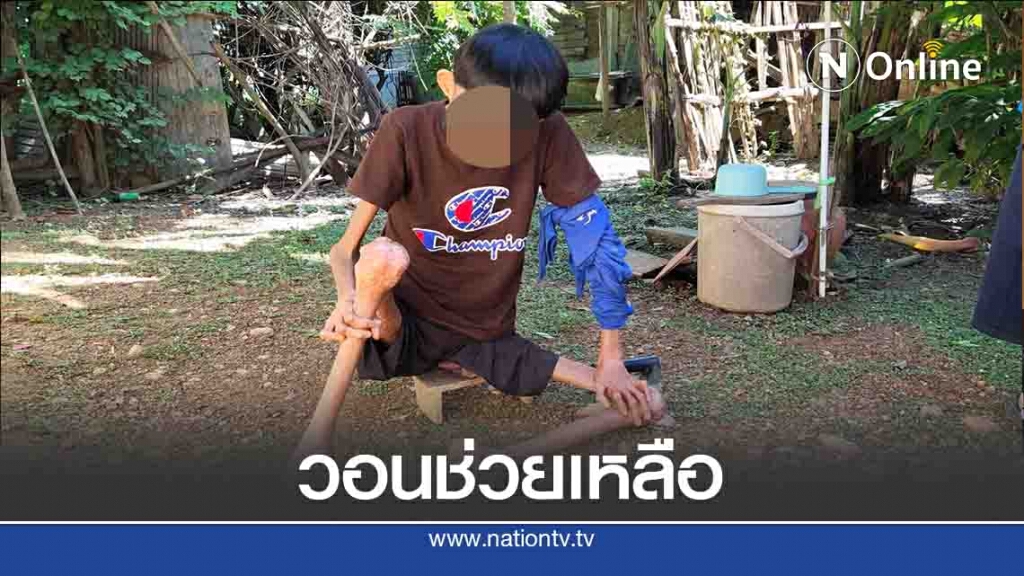 วอนช่วยเหลือหนุ่มพิการ-แขนขาลีบเหลือแต่กระดูก