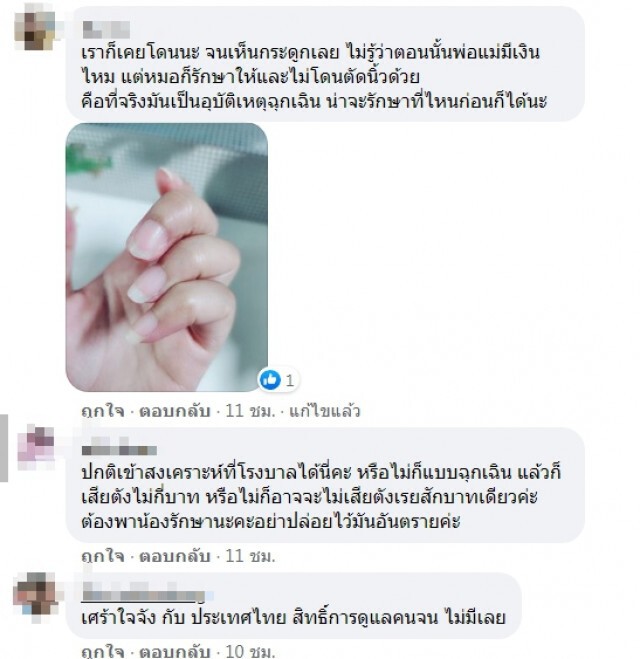 แม่ลูกอ่อน ช็อก ลูกน้อยวัย 7เดือน ซนจนเกือบโดนตัดนิ้ว