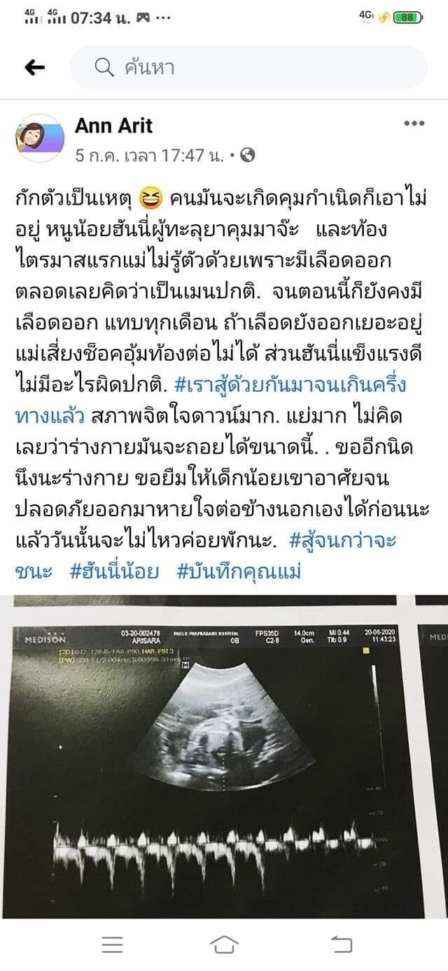 หดหู่ แม่ตั้งครรภ์ แม้รู้ว่าเสี่ยงถึงชีวิต แต่เก็บลูกไว้ สุดท้ายเศร้าทั้งบ้าน