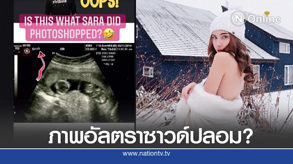 ชาวเน็ตจับผิด "ซาร่า" ภาพอัลตราซาวด์ปลอม เหมือนของ "เซเลน่า โกเมซ" ชาวเน็ตจับผิด "ซาร่า" ภาพอัลตราซาวด์ปลอม เหมือนของ "เซเลน่า โกเมซ"