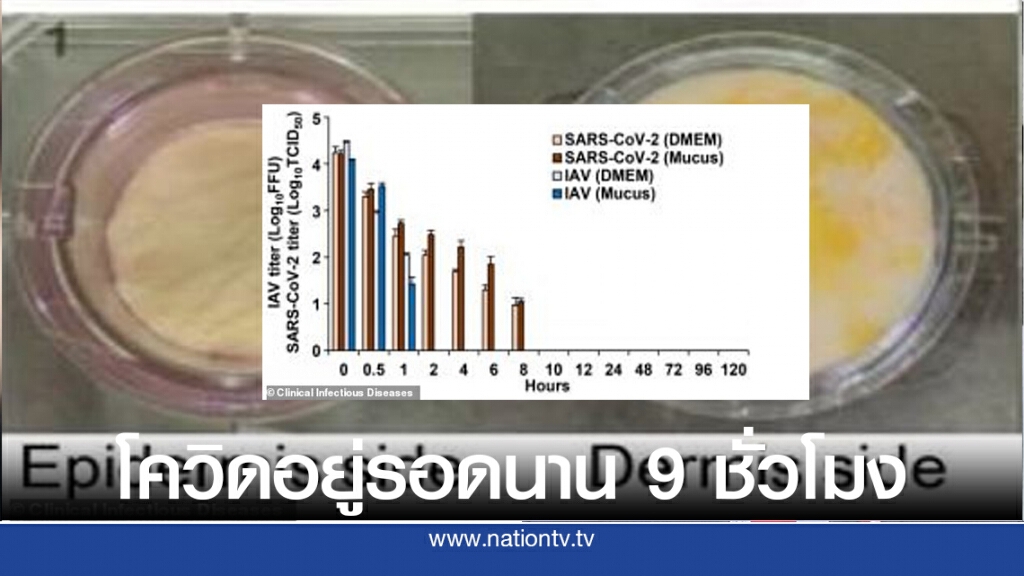 โควิด-19 อยู่รอดบนผิวหนังมนุษย์ได้นาน 9 ชั่วโมง โควิด-19 อยู่รอดบนผิวหนังมนุษย์ได้นาน 9 ชั่วโมง