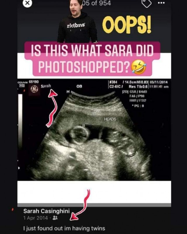 ชาวเน็ตจับผิด "ซาร่า" ภาพอัลตราซาวด์ปลอม เหมือนของ "เซเลน่า โกเมซ"