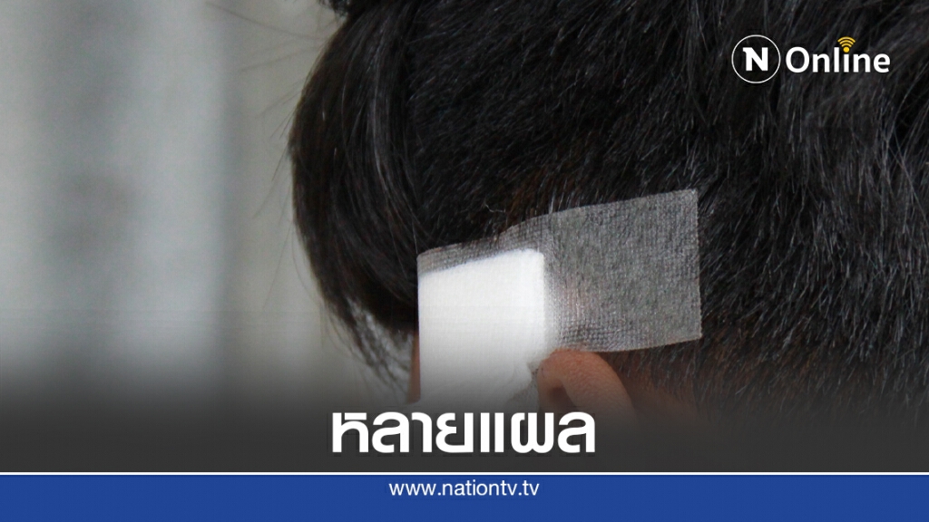 เที่ยวงานหมอลำถูกโจ๋เจ้าถิ่นรุมทำร้าย