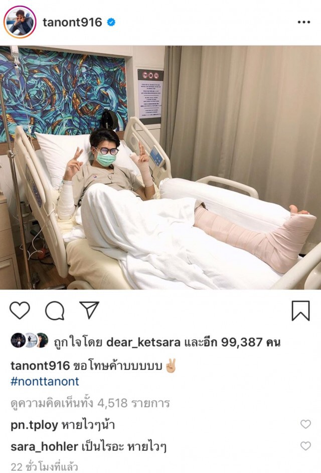 "นนท์ ธนนท์"ประสบอุบัติเหตุกระดูกนิ้วโป้งซ้ายหัก-เอ็นเข่าฉีก
