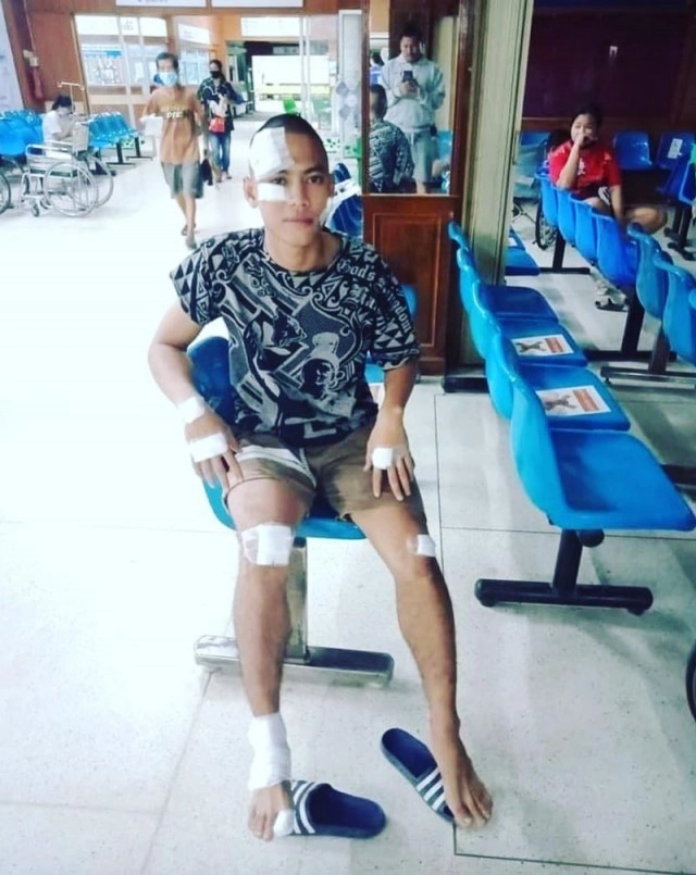 "น้องพี มกจ๊ก" ยังไม่ตาย! "จตุรงค์ มกจ๊ก" เผยภาพล่าสุด บาดเจ็บแผลเต็มตัว