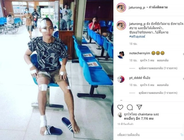 "น้องพี มกจ๊ก" ยังไม่ตาย! "จตุรงค์ มกจ๊ก" เผยภาพล่าสุด บาดเจ็บแผลเต็มตัว