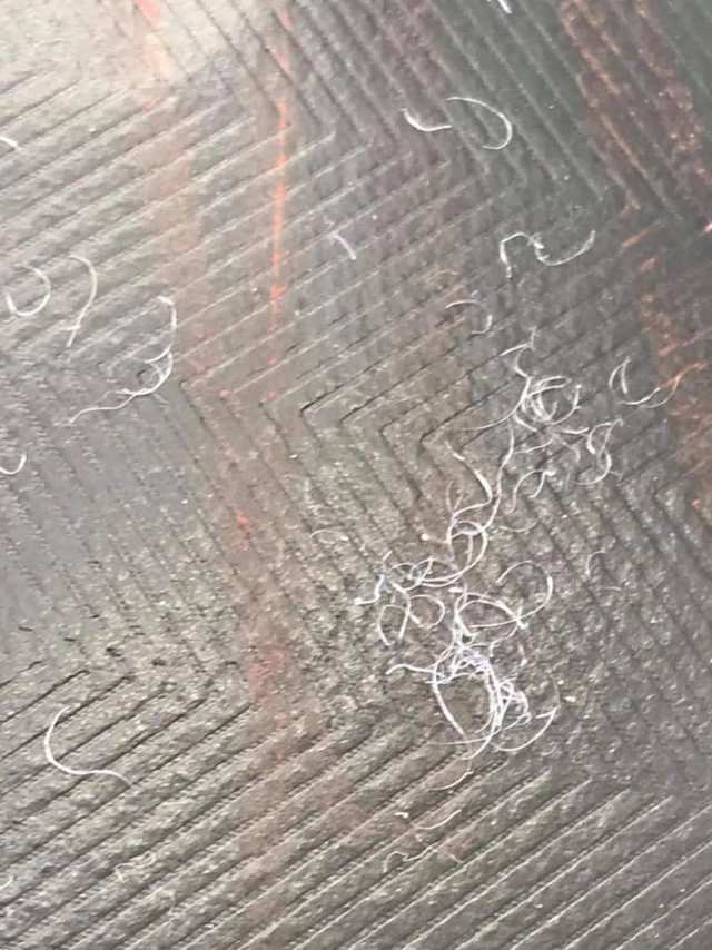 อุทาหรณ์ พ่อแม่ซื้อของออนไลน์ให้ลูก เกิดตุ่มแดงทั้งตัว แอดมิท รพ.ถึง2ครั้ง