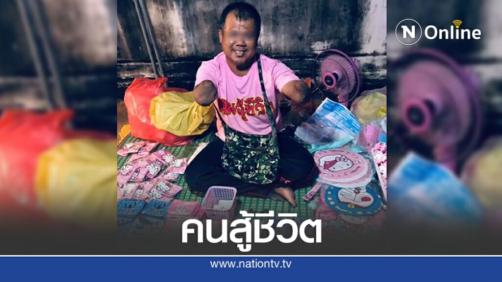 น่าชื่นชม หนุ่มพิการ แขนด้วนสองข้าง สู้ชีวิต ไม่คิดขอใครฟรีๆ