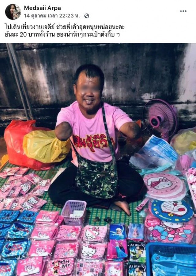 น่าชื่นชม หนุ่มพิการ แขนด้วนสองข้าง สู้ชีวิต ไม่คิดขอใครฟรีๆ