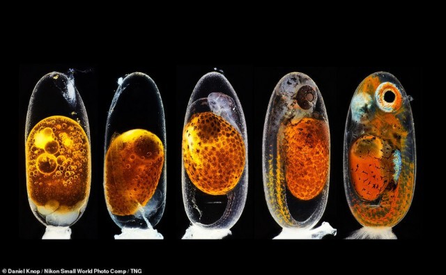 ภาพชนะการประกวดการถ่ายภาพวัตถุด้วยกล้องจุลทรรศน์ของนิคอน