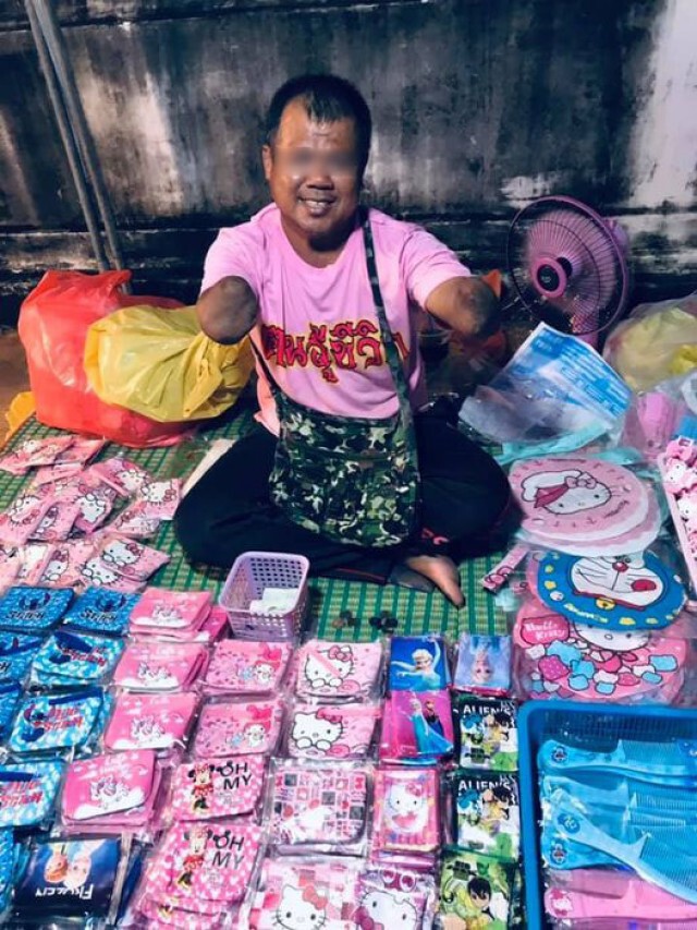 น่าชื่นชม หนุ่มพิการ แขนด้วนสองข้าง สู้ชีวิต ไม่คิดขอใครฟรีๆ