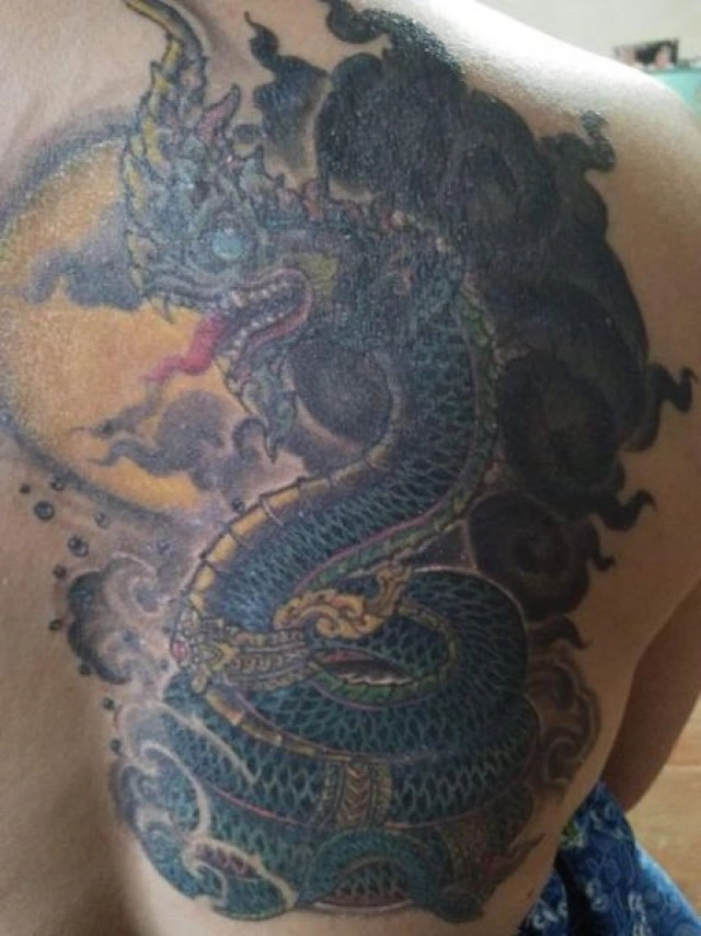 อัพเดท สาวสักพญานาค ช่างสักทำพิษ ติดเชื้ออย่างหนัก