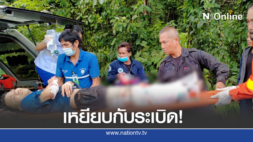 หนุ่มเข้าป่าเก็บเห็ด เหยียบกับระเบิดขาขาด หนุ่มเข้าป่าเก็บเห็ด เหยียบกับระเบิดขาขาด