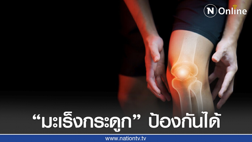 "มะเร็งกระดูก" ภัยเงียบที่ป้องกันได้