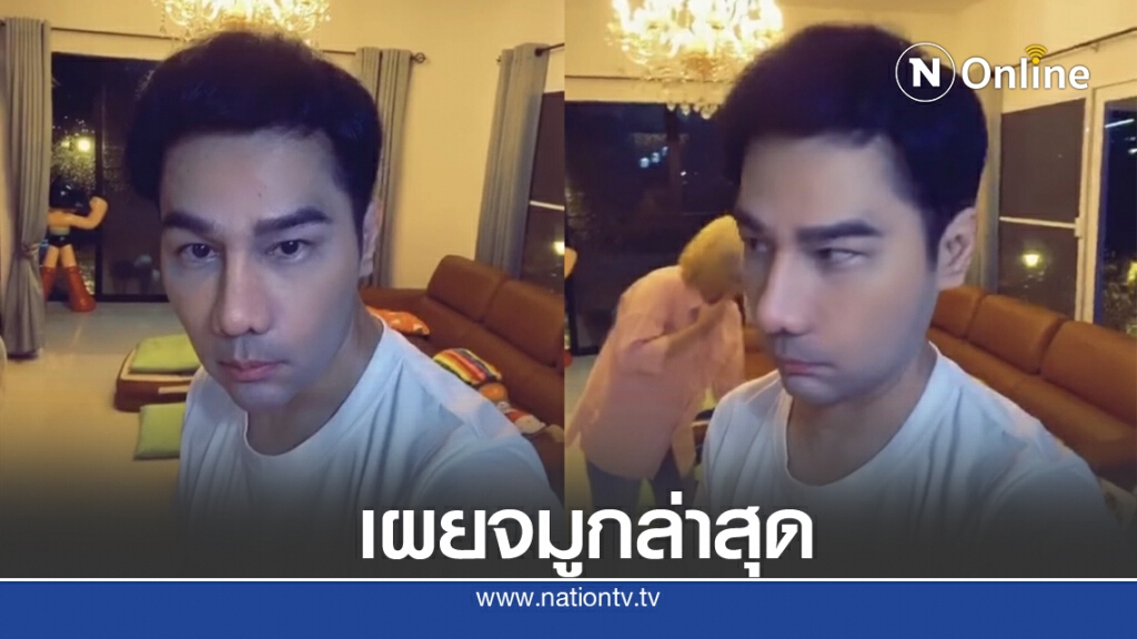 "กอล์ฟ เบญจพล" จมูกใหม่เข้าที่แล้ว แฟนคลับแห่ชม อย่างกับโอปป้าเกาหลี "กอล์ฟ เบญจพล" จมูกใหม่เข้าที่แล้ว แฟนคลับแห่ชม อย่างกับโอปป้าเกาหลี