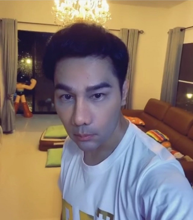 "กอล์ฟ เบญจพล" จมูกใหม่เข้าที่แล้ว แฟนคลับแห่ชม อย่างกับโอปป้าเกาหลี