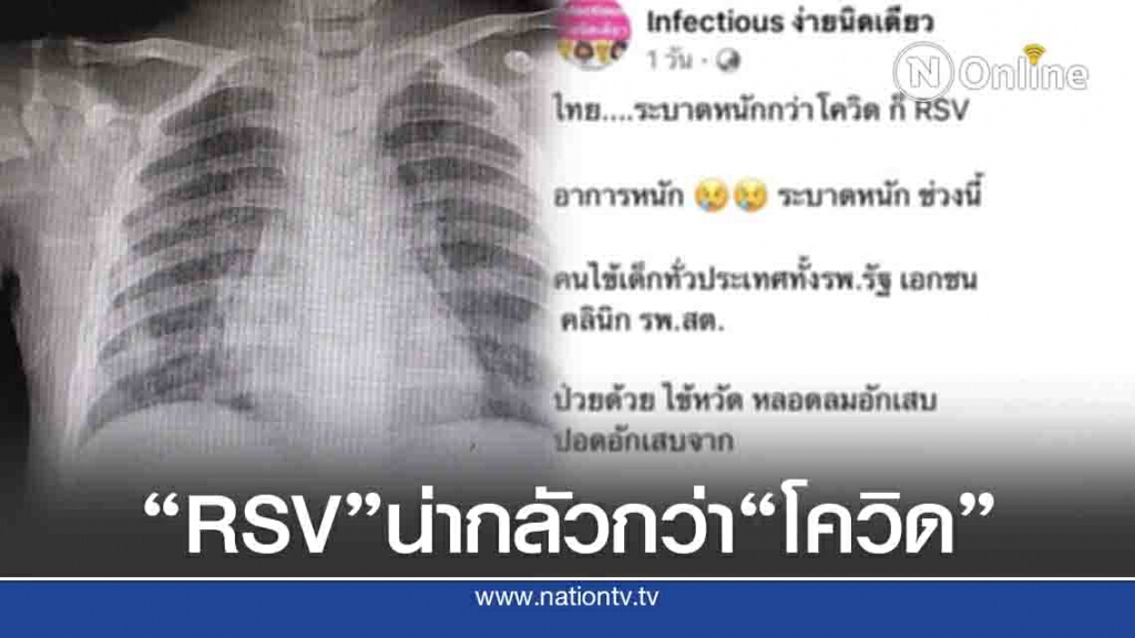 "ไวรัส RSV" ระบาดหนักกว่า "โควิด" เด็กป่วยทั่วประเทศแน่นทุกรพ. "ไวรัส RSV" ระบาดหนักกว่า "โควิด" เด็กป่วยทั่วประเทศแน่นทุกรพ.