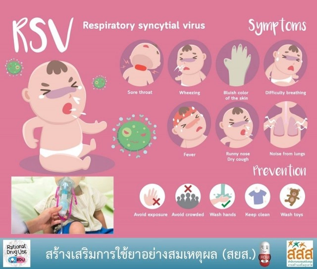 รู้เท่าทัน"RSV" ป้องกันการระบาดในเด็กช่วงปลายฝนต้นหนาว