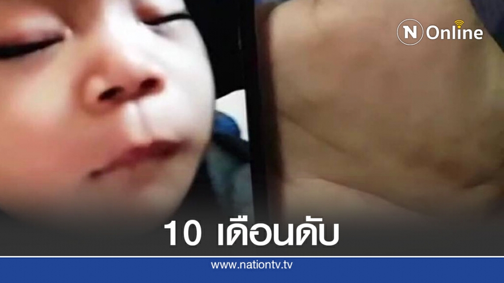 พ่อแม่โพสต์เตือนหลังลูก 10  เดือนติดเชื้อไวรัส RSV ดับ