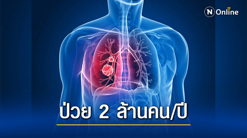 "พฤศจิกายน" เดือนแห่งการรณรงค์ต้านภัยมะเร็งปอด "พฤศจิกายน" เดือนแห่งการรณรงค์ต้านภัยมะเร็งปอด