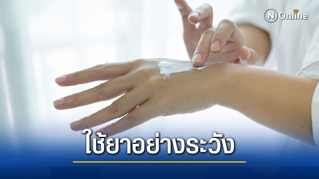 เตือน "ยาทาผสมสเตียรอยด์" คุณอนันต์-โทษมหันต์
