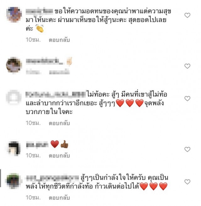 ชื่นชม หนุ่มสู้ชีวิตพิการแขนสองข้าง นั่งขายของข้างทางไม่ขอใครกิน !!