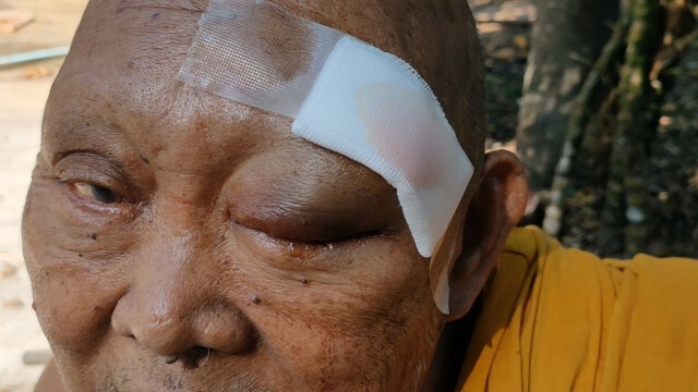 ผู้รับเหมามักง่ายลาดปูนทับฟุตบาทหลวงตาเดินบิณฑบาตสะดุดล้ม