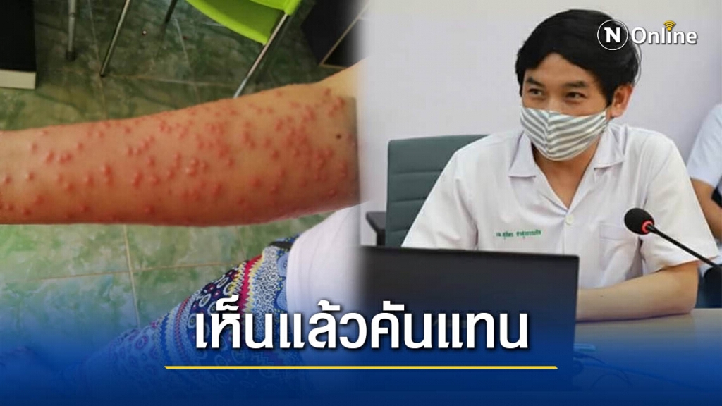 ช็อก! คนไข้ 233 ราย เกิดผื่นคันหลังทำนา หมอรู้สาเหตุ ลั่น 20 ปี ไม่เคยเจอ