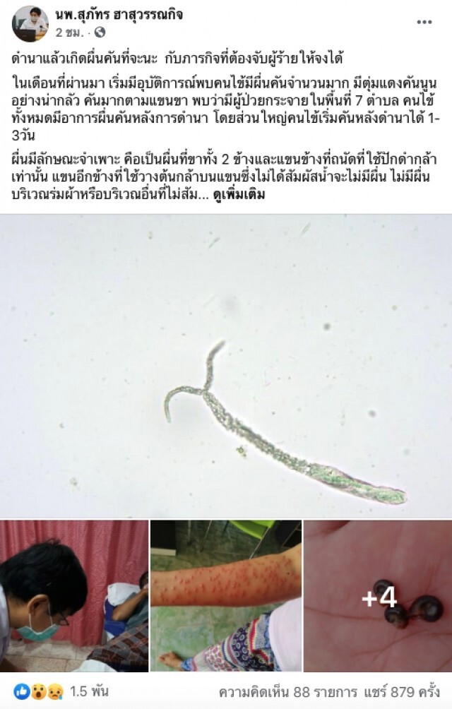ช็อก! คนไข้ 233 ราย เกิดผื่นคันหลังทำนา หมอรู้สาเหตุ ลั่น 20 ปี ไม่เคยเจอ