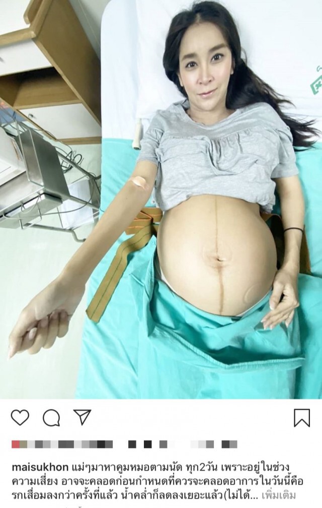 "ใหม่ สุคนธวา"เผยมีความเสี่ยงใกล้คลอดวอนอย่ายืมตังค์