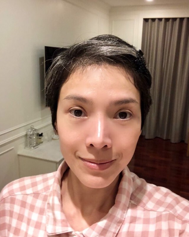 "นิ้ง" โพสต์ยกเลิกทำบอลลูนทางเดินอาหาร เหตุไข้ขึ้นสูงและเลือดซีด