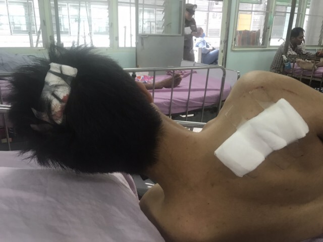 เหตุเกิดจากขอเฟซบุ๊คสาว! คู่อริเขม่นขับจยย.ไล่ฟันแผลเหวอะ