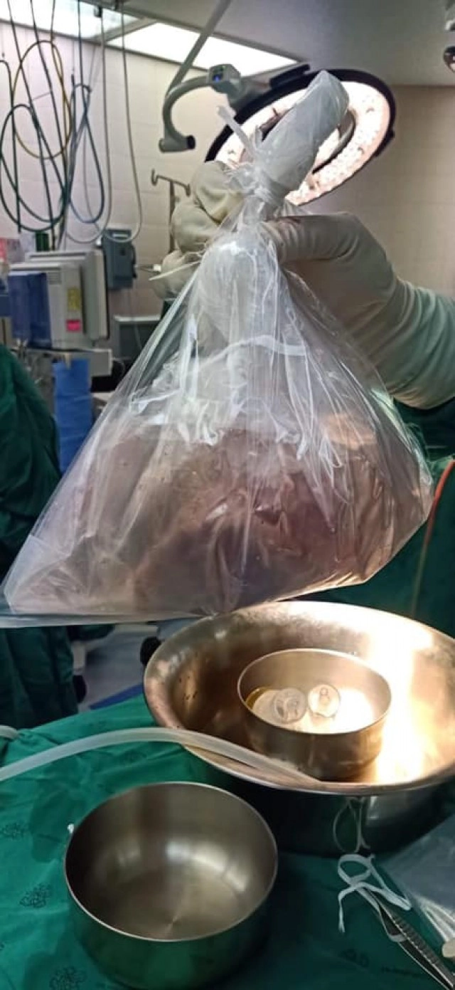 น้ำตาไหล! แม่ตัดสินใจ บริจาคหัวใจลูกชายที่เพิ่งเสียชีวิต ต่อลมหายใจให้ผู้อื่น