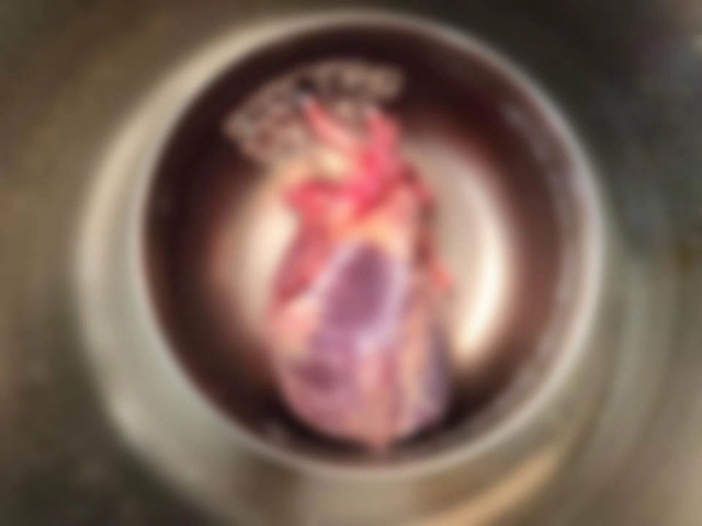 น้ำตาไหล! แม่ตัดสินใจ บริจาคหัวใจลูกชายที่เพิ่งเสียชีวิต ต่อลมหายใจให้ผู้อื่น