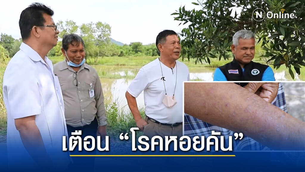 เร่งตรวจสอบ หลังชาวนาป่วยผื่นคัน กว่า 200 ราย เร่งตรวจสอบ หลังชาวนาป่วยผื่นคัน กว่า 200 ราย