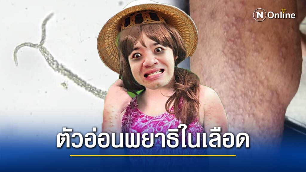 ชาวเน็ตไม่รู้จะโฟกัสจุดไหน "หมอแล็บ" โพสต์แจง "โรคหอยคัน"