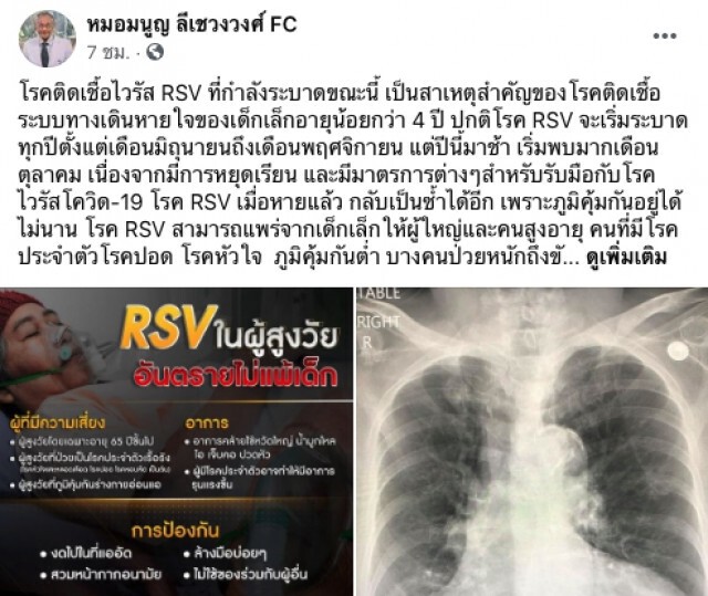 "หมอมนูญ" เตือน "ไวรัส RSV" แพร่สู่ผู้ใหญ่ได้ อันตรายถึงขั้นเสียชีวิต