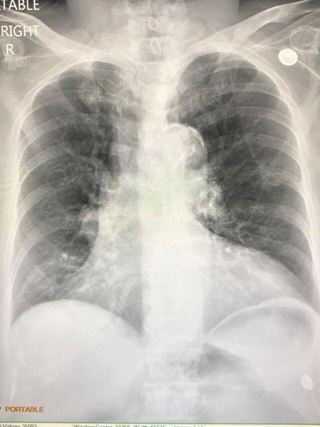 "หมอมนูญ" เตือน "ไวรัส RSV" แพร่สู่ผู้ใหญ่ได้ อันตรายถึงขั้นเสียชีวิต