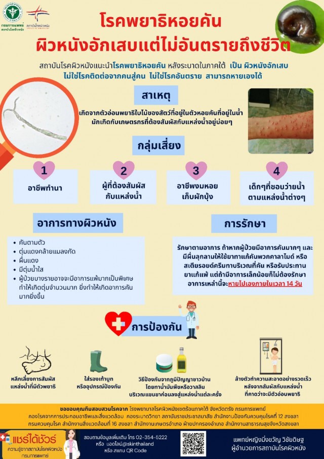 "แพทย์"แจง โรคพยาธิหอยคันแค่ผิวหนังอักเสบแต่ไม่อันตรายถึงชีวิต