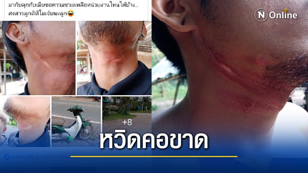 หวิดคอขาดอีกแล้ว สายสื่อสารปาดคอขณะขับรถ