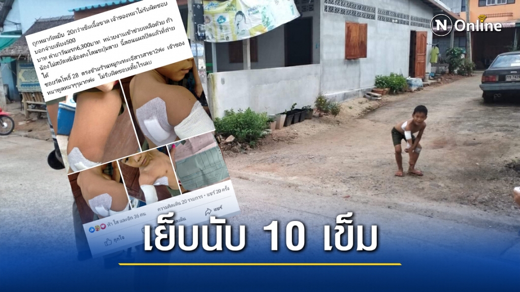 จ่อออกหมายเรียกเจ้าของสุนัขไล่กัดเด็ก เย็บกว่า 20 เข็ม