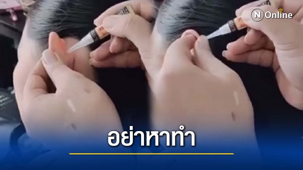 "หมอแล็บแพนด้า"เตือนอย่านำกาวมาทาหูเพื่อแก้ปัญหาหูกาง