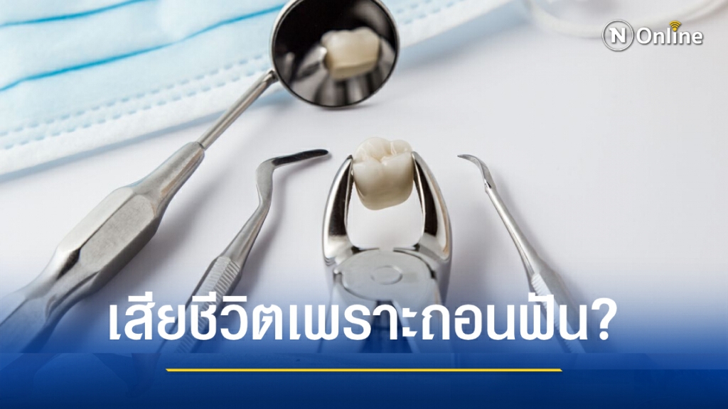 สาวไต้หวันเสียชีวิตหลังถอนฟันทีเดียว 20 ซี่