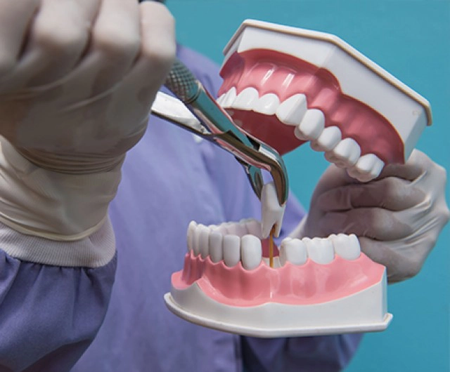 สาวไต้หวันเสียชีวิตหลังถอนฟันทีเดียว 20 ซี่