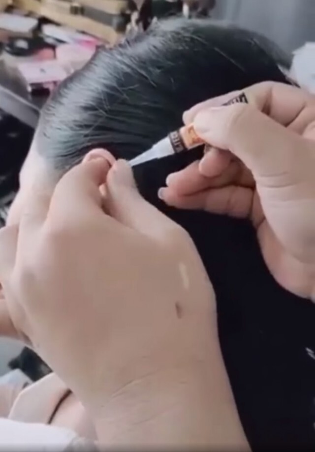 "หมอแล็บแพนด้า"เตือนอย่านำกาวมาทาหูเพื่อแก้ปัญหาหูกาง