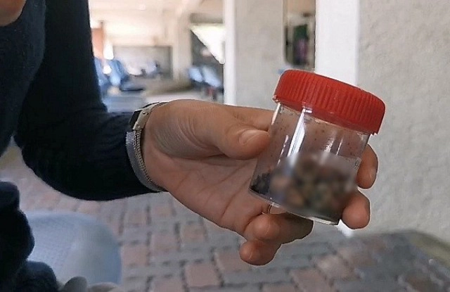 สาวไต้หวันเสียชีวิตหลังถอนฟันทีเดียว 20 ซี่